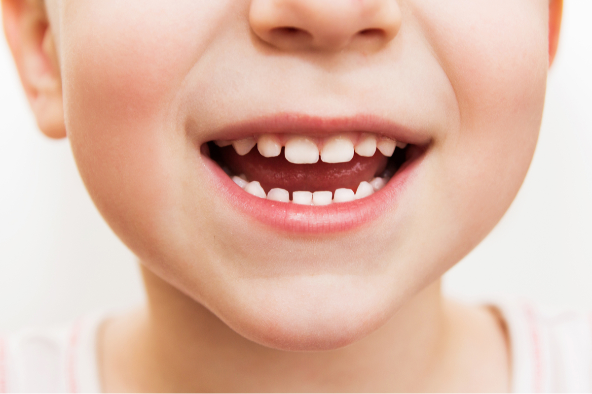 caring-for-your-child-s-teeth-kids-first-dentistry